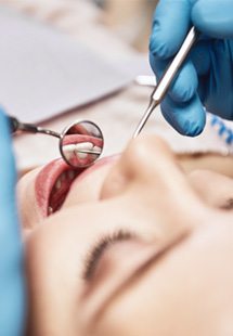 Dentist’s view as they examine a patient’s teeth wearing blue gloves